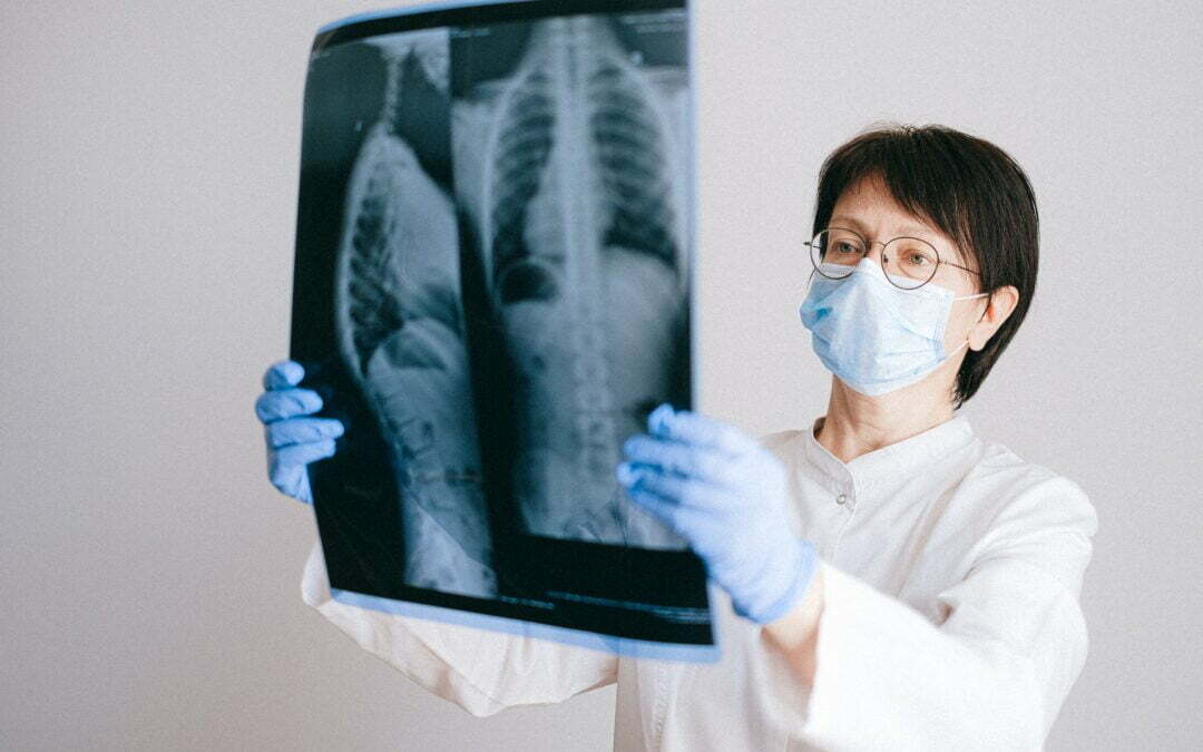 How Safe Are Chiropractic Xrays?