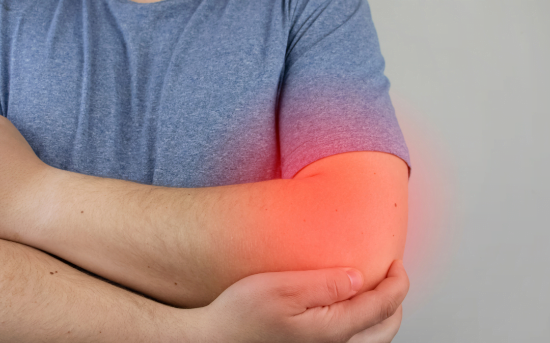 How Chiropractic Can Help Those Suffering From Elbow Bursitis